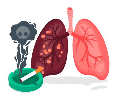 Effects of smoking on lungs